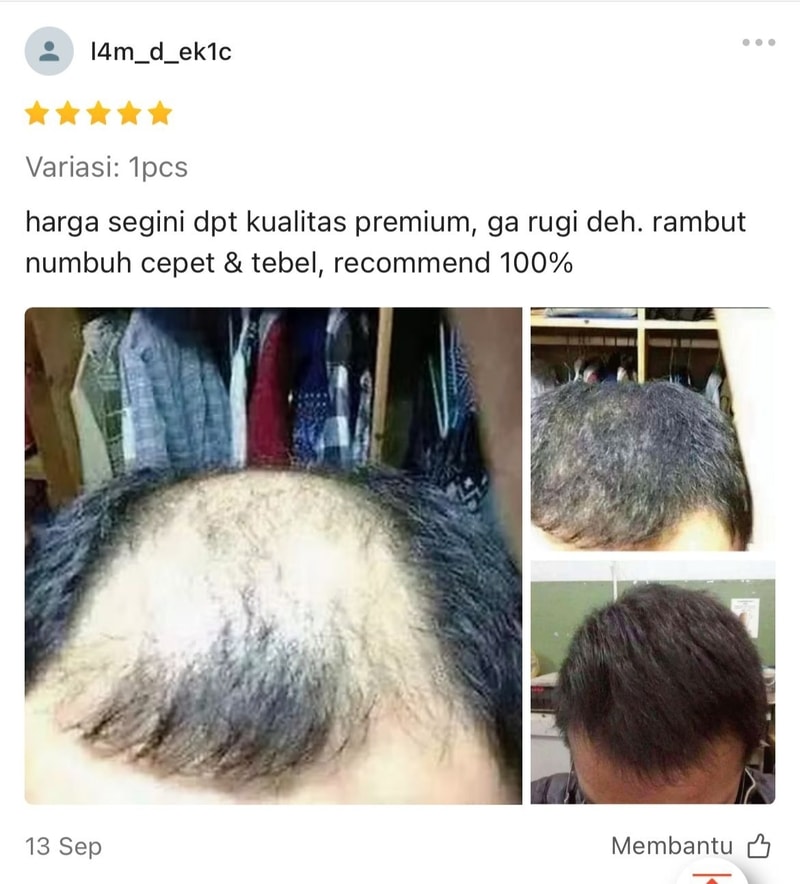 -